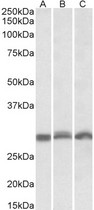 PSMA4 Antibody - Goat Anti-PSMA4 Antibody (0.3µg/ml) staining of NIH3T3 (A), Mouse Spleen (B), Rat Spleen (C)) lysates (35µg protein in RIPA buffer). Primary incubation was 1 hour. Detected by chemiluminescencence.