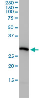 PSMA4 Antibody - PSMA4 monoclonal antibody (M01), clone 2A10-E4 Western Blot analysis of PSMA4 expression in HeLa.