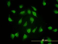 PSMA4 Antibody - Immunofluorescence of monoclonal antibody to PSMA4 on HeLa cell. [antibody concentration 10 ug/ml]