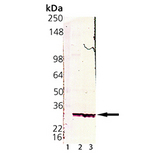 PSMA4 Antibody - Western blot of 20S Proteasome subunit alpha 4 monoclonal antibody (MCP34): Lane 1: MW marker, Lane 2: HeLa S100 fraction, Lane 3: HeLa cell lysate.