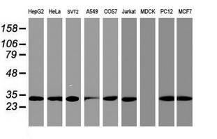 PSMA4 Antibody - Western blot of extracts (35 ug) from 9 different cell lines by using anti-PSMA4 monoclonal antibody.