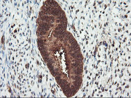 PSMA4 Antibody - IHC of paraffin-embedded Human endometrium tissue using anti-PSMA4 mouse monoclonal antibody.