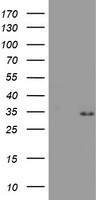 PSMA4 Antibody - HEK293T cells were transfected with the pCMV6-ENTRY control (Left lane) or pCMV6-ENTRY PSMA4 (Right lane) cDNA for 48 hrs and lysed. Equivalent amounts of cell lysates (5 ug per lane) were separated by SDS-PAGE and immunoblotted with anti-PSMA4.