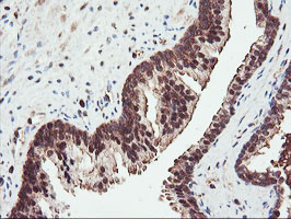 PSMA4 Antibody - IHC of paraffin-embedded Human prostate tissue using anti-PSMA4 mouse monoclonal antibody.