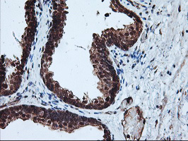 PSMA4 Antibody - IHC of paraffin-embedded Human prostate tissue using anti-PSMA4 mouse monoclonal antibody.