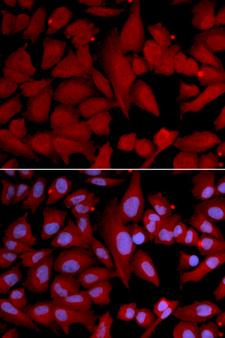 PSMA4 Antibody - Immunofluorescence analysis of U2OS cells.