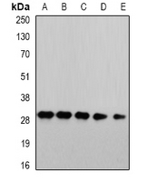 PSMA4 Antibody - Western blot analysis of PSMA4 expression in HepG2 (A); Jurkat (B); mouse liver (C); COS7 (D); PC12 (E) whole cell lysates.