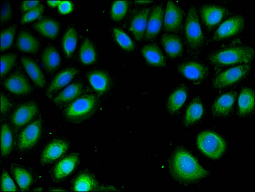 PSMA4 Antibody - Immunofluorescent analysis of A549 cells using PSMA4 Antibody at a dilution of 1:100 and Alexa Fluor 488-congugated AffiniPure Goat Anti-Rabbit IgG(H+L)