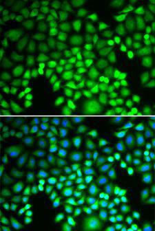 PSMA4 Antibody - Immunofluorescence analysis of U2OS cells using PSMA4 antibody. Blue: DAPI for nuclear staining.