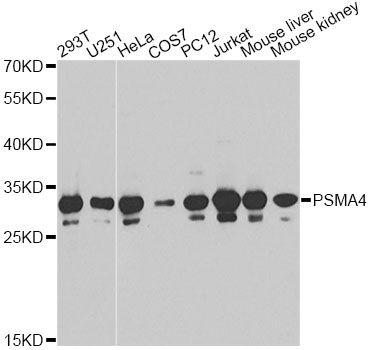 PSMA4 Antibody - Western blot analysis of extracts of various cell lines, using PSMA4 antibody at 1:1000 dilution. The secondary antibody used was an HRP Goat Anti-Rabbit IgG (H+L) at 1:10000 dilution. Lysates were loaded 25ug per lane and 3% nonfat dry milk in TBST was used for blocking.