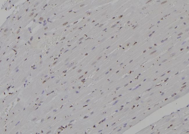 PSMA4 Antibody - 1:100 staining rat heart tissue by IHC-P. The sample was formaldehyde fixed and a heat mediated antigen retrieval step in citrate buffer was performed. The sample was then blocked and incubated with the antibody for 1.5 hours at 22°C. An HRP conjugated goat anti-rabbit antibody was used as the secondary.