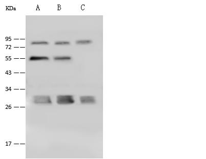 PSMA4 Antibody - Anti-PSMA4 rabbit polyclonal antibody at 1:500 dilution. Lane A: HeLa Whole Cell Lysate. Lane B: Jurkat Whole Cell Lysate. Lane C: K562 Whole Cell Lysate. Lysates/proteins at 30 ug per lane. Secondary: Goat Anti-Rabbit IgG (H+L)/HRP at 1/10000 dilution. Developed using the ECL technique. Performed under reducing conditions. Predicted band size: 29 kDa. Observed band size: 29 kDa.