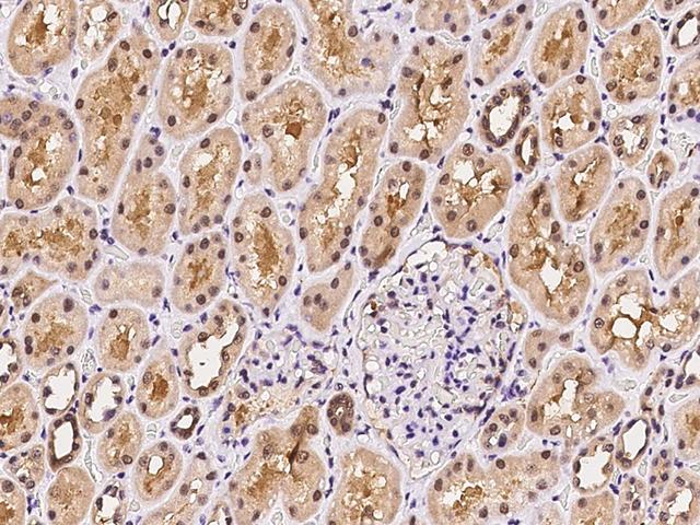 PSMA4 Antibody - Immunochemical staining of human PSMA4 in human liver with rabbit polyclonal antibody at 1:500 dilution, formalin-fixed paraffin embedded sections.