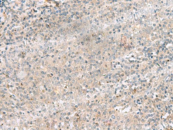 PSMA4 Antibody - Immunohistochemistry of paraffin-embedded Human tonsil tissue  using PSMA4 Polyclonal Antibody at dilution of 1:45(×200)