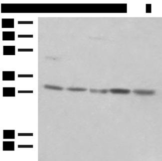 PSMA4 Antibody - Western blot analysis of NIH/3T3 cell Mouse spleen tissue K562 cell Hela cell 231 cell lysates  using PSMA4 Polyclonal Antibody at dilution of 1:400