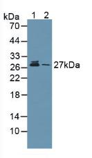 PSMA5 Antibody - Western Blot; Sample: Lane1: Human Lung Tissue; Lane2: Human Hela Cells.