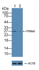 PSMA5 Antibody - Knockout Varification: Lane 1: Wild-type Hela cell lysate; Lane 2: PSMa5 knockout Hela cell lysate; Predicted MW: 26,20kd Observed MW: 27kd Primary Ab: 1µg/ml Rabbit Anti-Human PSMa5 Antibody Second Ab: 0.2µg/mL HRP-Linked Caprine Anti-Rabbit IgG Polyclonal Antibody