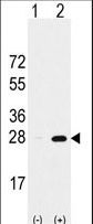 PSMA5 Antibody - Western blot of PSMA5 (arrow) using rabbit polyclonal PSMA5 Antibody. 293 cell lysates (2 ug/lane) either nontransfected (Lane 1) or transiently transfected with the PSMA5 gene (Lane 2) (Origene Technologies).