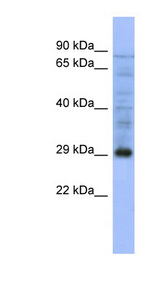 PSMA5 Antibody - PSMA5 / ZETA antibody western blot of Human Jurkat lysate.  This image was taken for the unconjugated form of this product. Other forms have not been tested.