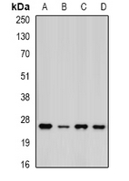 PSMA5 Antibody - Western blot analysis of PSMA5 expression in MCF7 (A); HepG2 (B); mouse liver (C); mouse heart (D) whole cell lysates.
