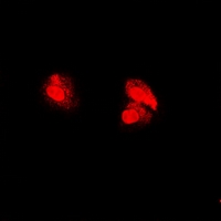 PSMA5 Antibody - Immunofluorescent analysis of PSMA5 staining in U2OS cells. Formalin-fixed cells were permeabilized with 0.1% Triton X-100 in TBS for 5-10 minutes and blocked with 3% BSA-PBS for 30 minutes at room temperature. Cells were probed with the primary antibody in 3% BSA-PBS and incubated overnight at 4 deg C in a humidified chamber. Cells were washed with PBST and incubated with a DyLight 594-conjugated secondary antibody (red) in PBS at room temperature in the dark.