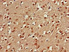 PSMA5 Antibody - Immunohistochemistry of paraffin-embedded human brain tissue at dilution of 1:100