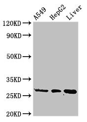 PSMA5 Antibody - Western Blot Positive WB detected in:A549 whole cell lysate,HepG2 whole cell lysate,Rat liver tissue All Lanes:PSMA5 antibody at 3µg/ml Secondary Goat polyclonal to rabbit IgG at 1/50000 dilution Predicted band size: 27,21 KDa Observed band size: 27 KDa