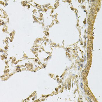 PSMA5 Antibody - Immunohistochemistry of paraffin-embedded rat lung using PSMA5 Antibody at dilution of 1:100 (40x lens).
