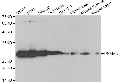 PSMA5 Antibody - Western blot analysis of extracts of various cell lines, using PSMA5 antibody at 1:1000 dilution. The secondary antibody used was an HRP Goat Anti-Rabbit IgG (H+L) at 1:10000 dilution. Lysates were loaded 25ug per lane and 3% nonfat dry milk in TBST was used for blocking.