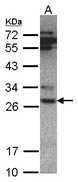 PSMA6 Antibody - Sample (30 ug whole cell lysate). A: Hep G2 . 7.5% SDS PAGE. PSMA6 antibody diluted at 1:500