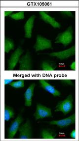 PSMA6 Antibody - Immunofluorescence of paraformaldehyde-fixed HeLa using 20S Proteasome alpha 6 antibody at 1:200 dilution.