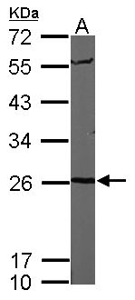 PSMA6 Antibody - Sample (50 ug of whole cell lysate). A: Mouse brain. 12% SDS PAGE. PSMA6 antibody diluted at 1:1000.