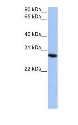 PSMA6 Antibody - Jurkat cell lysate. Antibody concentration: 0.5 ug/ml. Gel concentration: 12%.  This image was taken for the unconjugated form of this product. Other forms have not been tested.