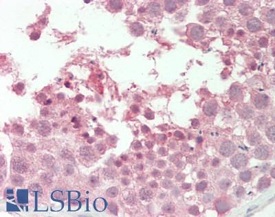 PSMA6 Antibody - Human Testis: Formalin-Fixed, Paraffin-Embedded (FFPE).  This image was taken for the unconjugated form of this product. Other forms have not been tested.