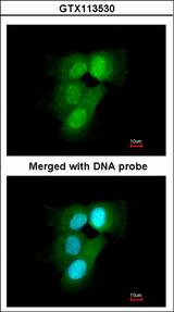 PSMA6 Antibody - Immunofluorescence of paraformaldehyde-fixed A431 using 20S Proteasome alpha6 antibody at 1:200 dilution.