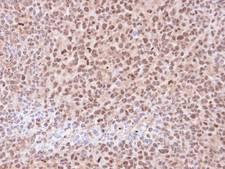 PSMA6 Antibody - IHC of paraffin-embedded H1299 xenograft using 20S Proteasome alpha6 antibody at 1:100 dilution.