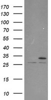 PSMA6 Antibody - HEK293T cells were transfected with the pCMV6-ENTRY control (Left lane) or pCMV6-ENTRY PSMA6 (Right lane) cDNA for 48 hrs and lysed. Equivalent amounts of cell lysates (5 ug per lane) were separated by SDS-PAGE and immunoblotted with anti-PSMA6.