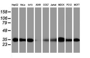 PSMA6 Antibody - Western blot of extracts (35 ug) from 9 different cell lines by using g anti-PSMA6 monoclonal antibody (HepG2: human; HeLa: human; SVT2: mouse; A549: human; COS7: monkey; Jurkat: human; MDCK: canine; PC12: rat; MCF7: human).