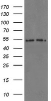 PSMA6 Antibody - HEK293T cells were transfected with the pCMV6-ENTRY control (Left lane) or pCMV6-ENTRY PSMA6 (Right lane) cDNA for 48 hrs and lysed. Equivalent amounts of cell lysates (5 ug per lane) were separated by SDS-PAGE and immunoblotted with anti-PSMA6.