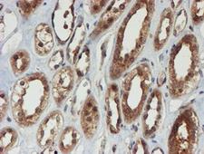 PSMA6 Antibody - IHC of paraffin-embedded Human Kidney tissue using anti-PSMA6 mouse monoclonal antibody.