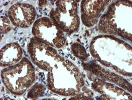 PSMA6 Antibody - IHC of paraffin-embedded Human prostate tissue using anti-PSMA6 mouse monoclonal antibody.