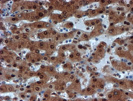 PSMA6 Antibody - IHC of paraffin-embedded Human liver tissue using anti-PSMA6 mouse monoclonal antibody.