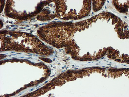 PSMA6 Antibody - IHC of paraffin-embedded Human prostate tissue using anti-PSMA6 mouse monoclonal antibody.
