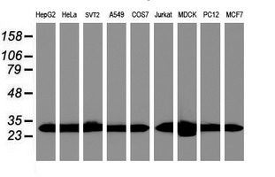 PSMA6 Antibody - Western blot of extracts (35 ug) from 9 different cell lines by using g anti-PSMA6 monoclonal antibody (HepG2: human; HeLa: human; SVT2: mouse; A549: human; COS7: monkey; Jurkat: human; MDCK: canine; PC12: rat; MCF7: human).