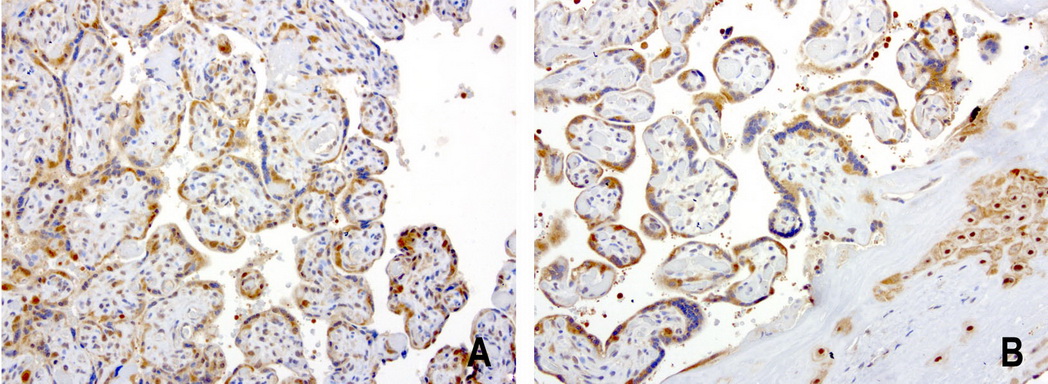 PSMA6 Antibody - Immunohistochemical staining of 2 cases of paraffin-embedded human placenta using anti-PSMA6 clone UMAB102 mouse monoclonal antibody  at 1:200 with Polink2 Broad HRP DAB detection kit; heat-induced epitope retrieval with GBI Citrate pH6.0 HIER buffer using pressure chamber for 3 minutes at 110C. Staining is nuclear, cytoplasmic, and membraneous in trophoblasts cells of the placenta.