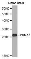 PSMA6 Antibody - Western blot of extracts of human brain cell lines, using PSMA6 antibody.