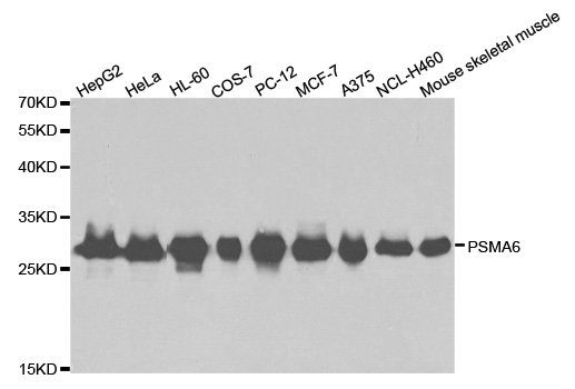 PSMA6 Antibody - Western blot analysis of extracts of various cell lines.