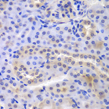 PSMA6 Antibody - Immunohistochemistry of paraffin-embedded mouse kidney tissue.