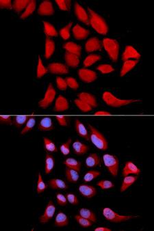 PSMA6 Antibody - Immunofluorescence analysis of U2OS cells.