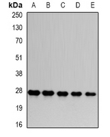 PSMA6 Antibody - Western blot analysis of PSMA6 expression in HepG2 (A); HeLa (B); mouse skeletal muscle (C); PC12 (D); COS7 (E) whole cell lysates.